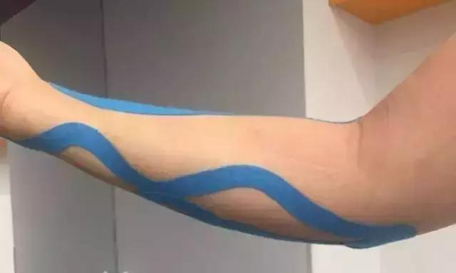 康复训练时手腕手指肿痛怎么缓解,手腕疼的康复练习