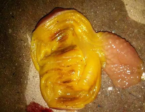 腺肌胃炎最简单方法,腺肌胃炎最佳治疗方法