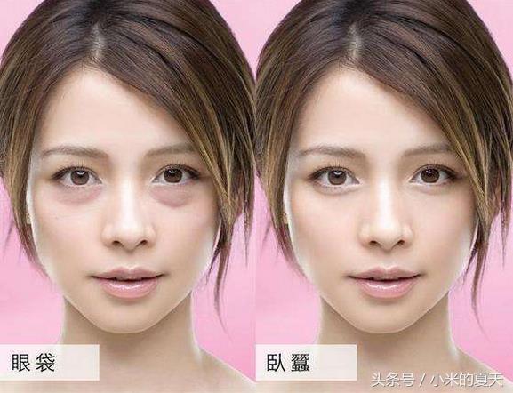 罗志祥眼袋是怎么形成的,罗志祥眼袋深度解析