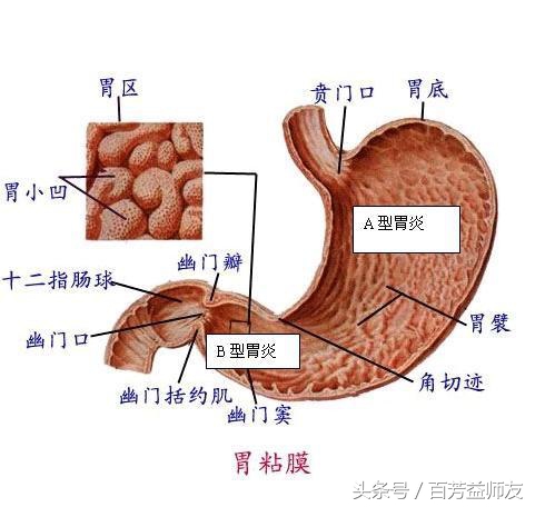 中医治疗胃痛反酸的方子,专治胃病胃酸胃痛处方