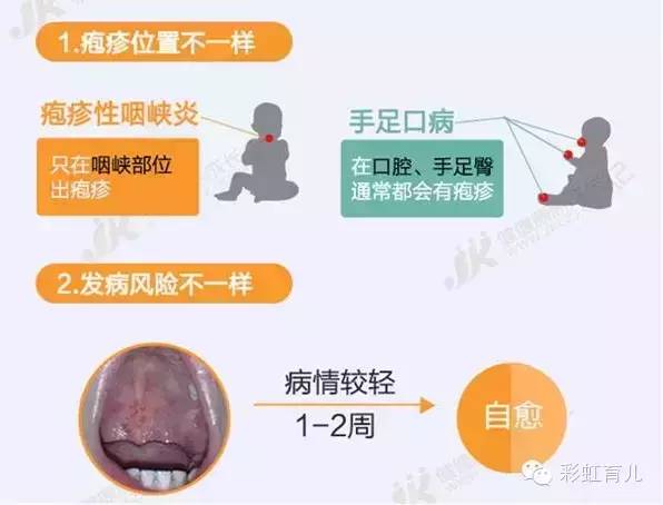 宝宝易出汗咳嗽,宝宝感冒气喘咳嗽怎么治疗最有效