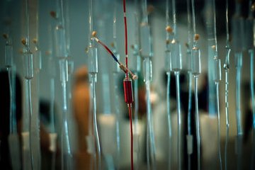 肾病患者饮食日记,肾病患者看的书