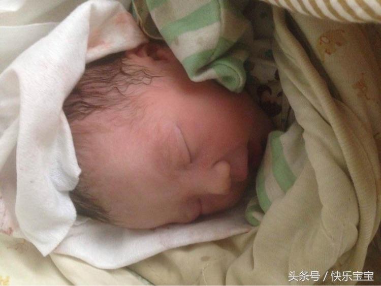 孕妈顺产开十指过程,生宝宝顺产撕裂程度