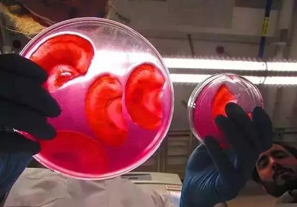 这位生物黑客教授竟然从苹果中培育出耳朵，功能与常人无异