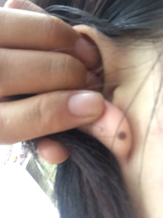 嘴角右边有痣代表什么含义女人,手指各个地方长痣的不同含义