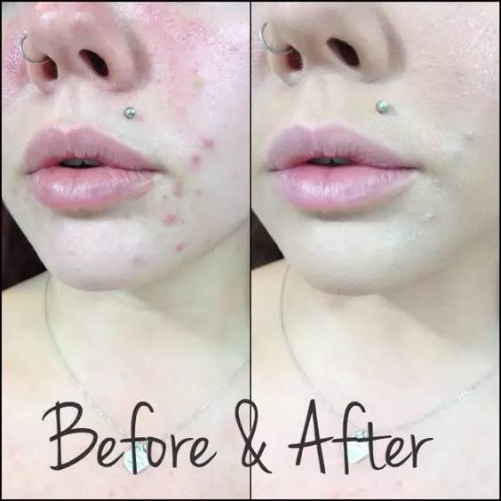 最好用的遮瑕神器,遮瑕神器排行榜第一