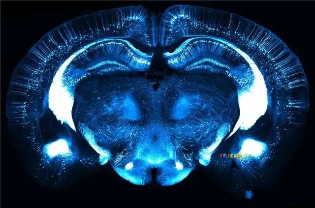 显微镜奇妙世界,显微镜下的奇妙世界视频