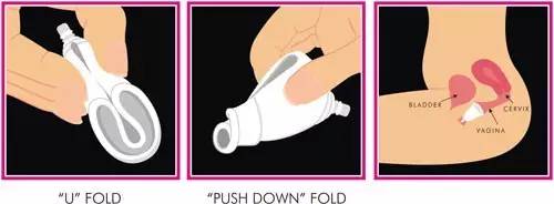 女生月经杯使用方法,女性月经杯怎样使用