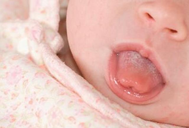 宝宝上火了怎么降火最快最好,宝宝上火了怎样降火最快最有效