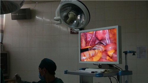 节育环会导致身体一直发炎吗,节育环会引发感染吗