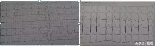 心内医生看过来，反复腹胀12年，她到底得了什么病？