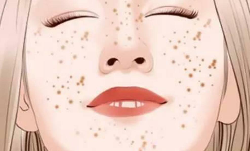 小孩长雀斑去除最快的方法,儿童雀斑怎么去除掉最快方法