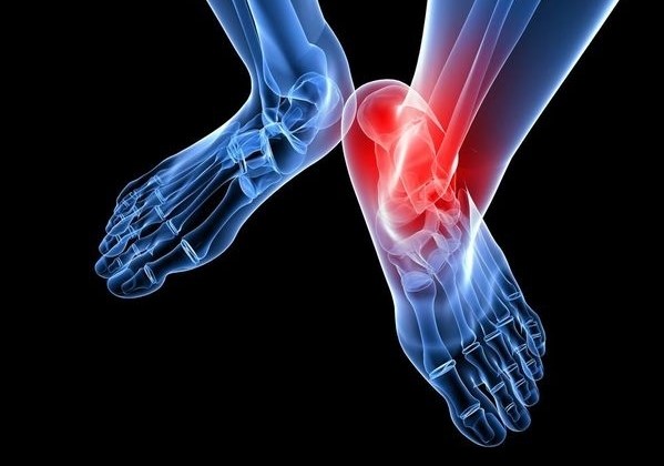 防止足跟长骨刺的鞋,脚后跟有骨刺要购买什么鞋