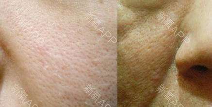 桃桃养生护肤,桃桃美容护肤