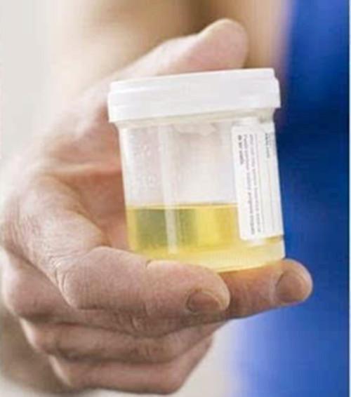 尿检指标科学解读！