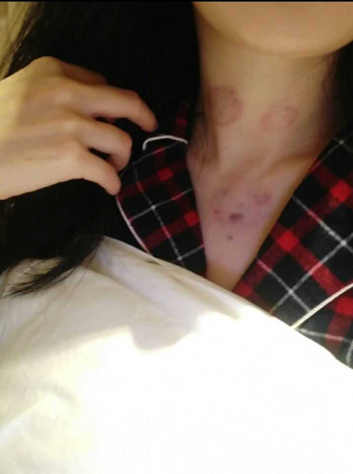 大幂幂干活不要命，生病以至要接受放血治疗，但又被媒体黑是什么梗，网友直逼媒体道歉