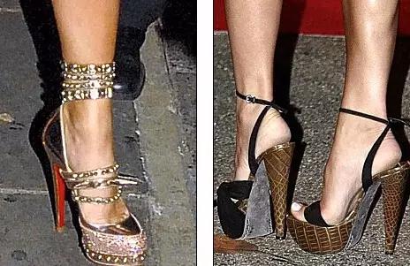 贝克汉姆老婆脚外翻,贝克汉姆老婆的脚拇外翻