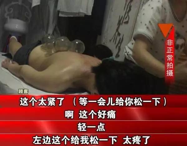 男子拔火罐被烧伤,男子拔罐被烧伤
