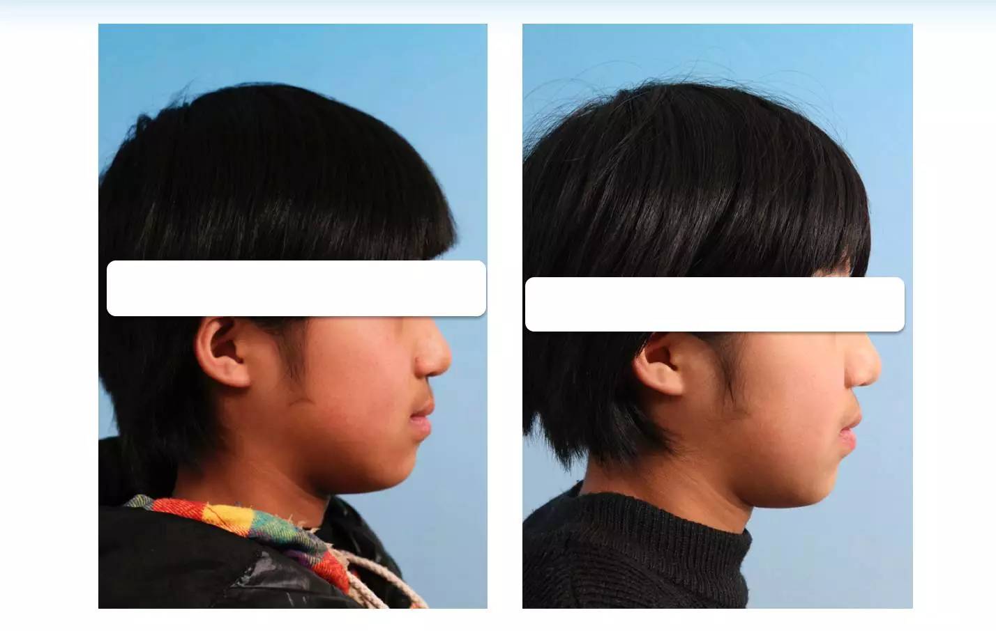 医生郭涛,正畸郭涛