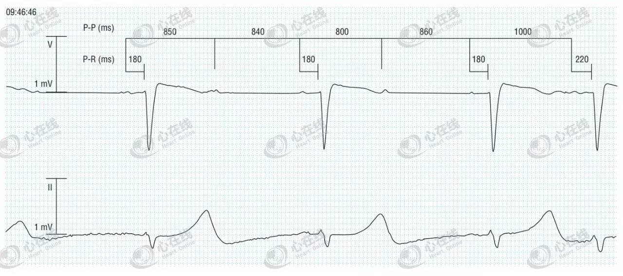 必杀技完整电影版,必杀技一招致命