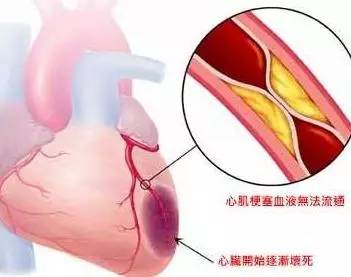 从小中暑到中暑有何征兆,三天两头有中暑症状