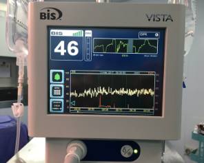 围手术期个案护理比赛优秀案例ppt,术后镇痛的规范化管理ppt