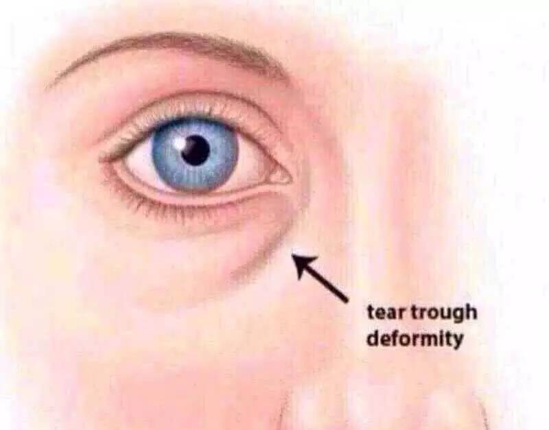 毛孔磨皮滤镜,磨皮滤镜有哪些