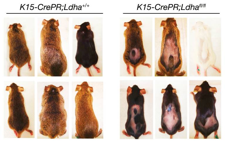 自然子刊证实,自然卷脱发能自愈吗