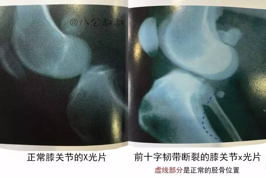 狗狗得关节炎常见的症状有哪些,狗狗膝关节最佳治疗方法