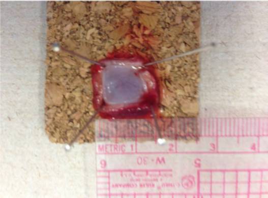 内镜下肌切开术手术步骤,肌肉活检最新技术