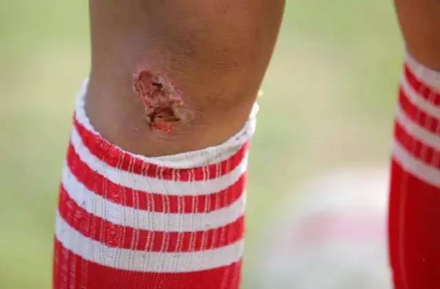 这群15岁就会结婚的女孩，一边捡垃圾一边踢球，竟连续三年勇夺世界冠军