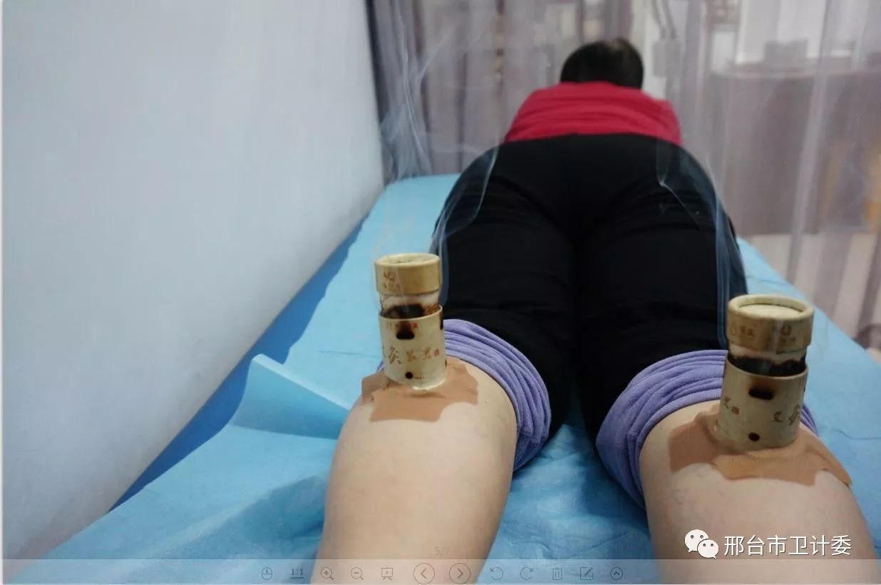 十大举措提升群众看病就医满意度,提升医疗保障水平群众看病不再难