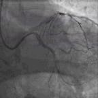 典型病例及处理方法,典型病例分析及治疗方法