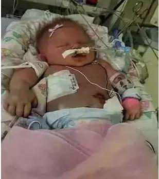 亲吻有毒，爱宝宝，就不要给他“黑暗之吻”