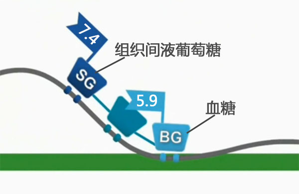 雅培瞬感血糖多久最准确,雅培动态血糖结果解读