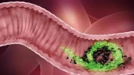 暗沉肤色最快的方法,肤色暗沉怎么破一招教你恢复白皙