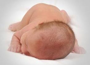 宝宝头发稀疏发黄怎么改善,宝宝头发黄怎么理