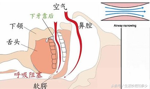 室友打呼噜怎么叫醒他,自己在宿舍打呼噜好尴尬
