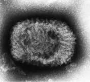 狂犬病毒vs埃博拉病毒,埃博拉病毒和狂犬病毒哪个更厉害