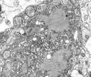 狂犬病毒vs埃博拉病毒,埃博拉病毒和狂犬病毒哪个更厉害