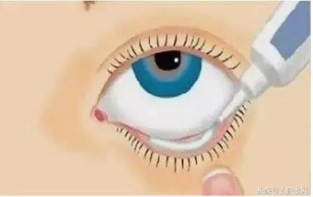 常用滴眼液：开启后使用期限和注意事项！