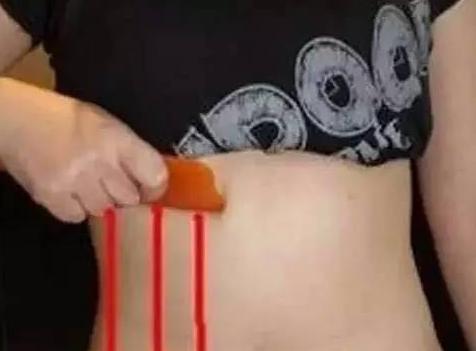 强力燃脂减肚子赘肉,只需每天刮2下,就能让你轻松拥有迷人马甲线!