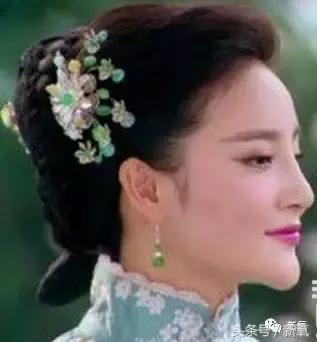 做了个达拉斯隆鼻，假体直接戳到脑门，我是不是和张檬、刘雨欣遇到了同一个医生！