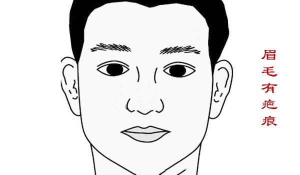 男子夫妻宫有疤痕有什么影响,女人在太阳穴有疤克夫吗