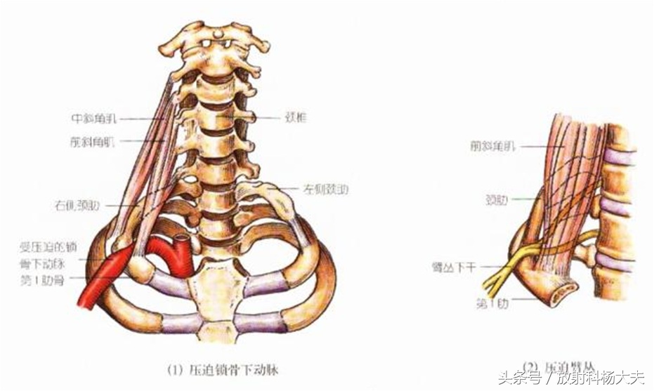 脖子比普通人长一倍,脖子好像比别人长一点