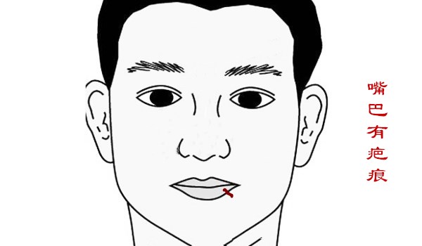 男子夫妻宫有疤痕有什么影响,女人在太阳穴有疤克夫吗