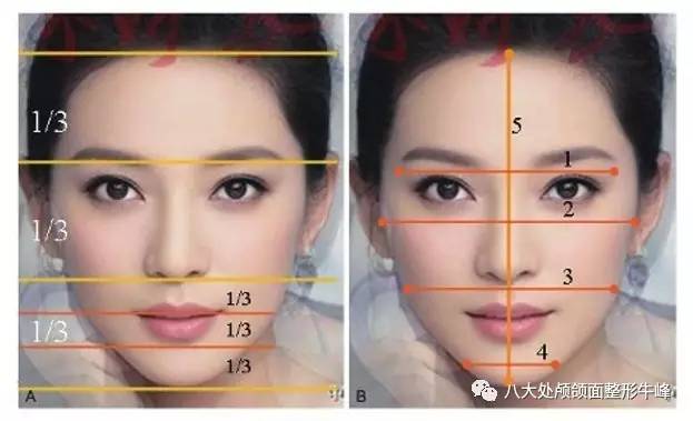 颧骨突出截骨手术的全过程,颧骨截骨多久恢复