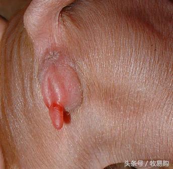 猪饲料中的这一毒素的毒性竟然是氰化钾的10倍,*霜砒**的68倍!