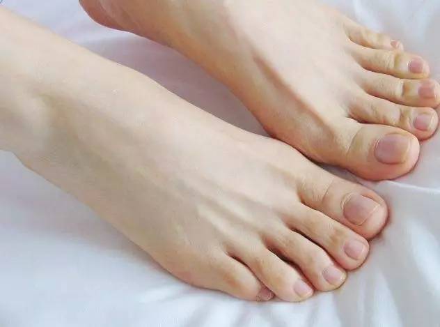 脚上穿凉鞋晒出印怎么去除,脚上有凉鞋印怎么去除