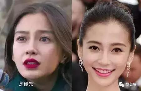 牙齿发黄是不是因为营养不良,牙齿黄被人嫌弃